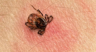Kene ısırığı vakalarında ciddi artış! 15 gün boyunca kan emerek yaşarlar: